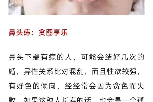 漂亮痣相的象征意义：它们究竟暗示了什么