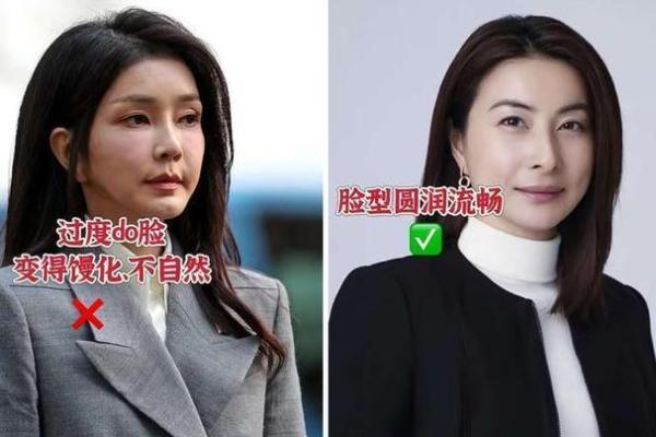 嘴边纹显富贵气